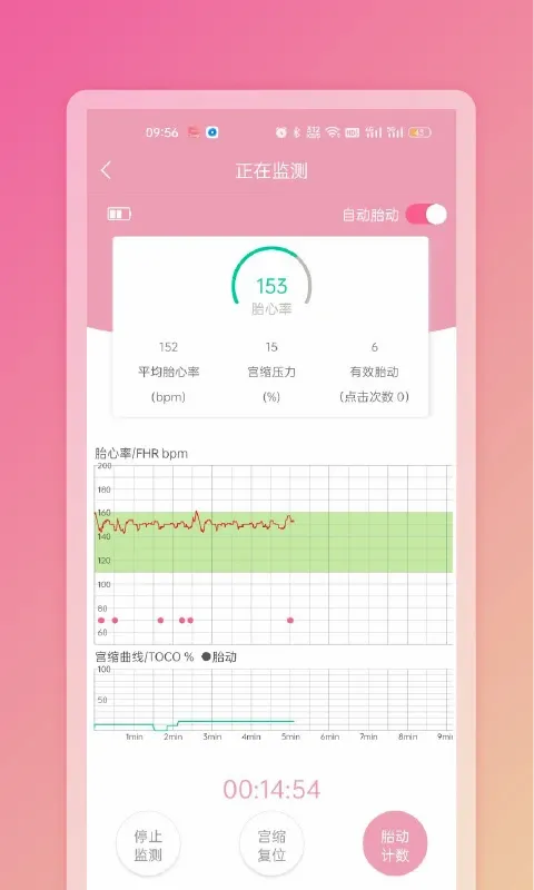 Fetaphon Homev1.0.27 �ֻ���